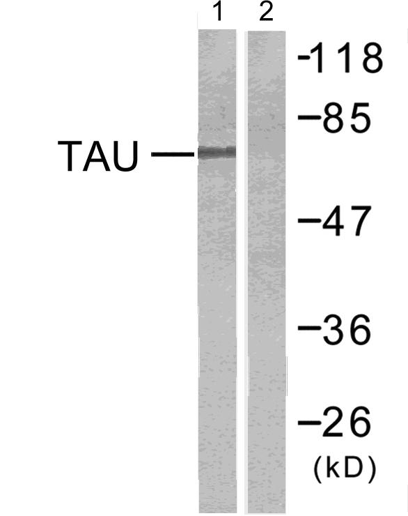 Rabbit Polyclonal Antibody to Tau