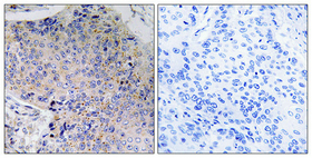 Rabbit Polyclonal Antibody to Tau