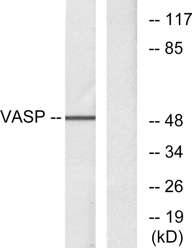 Rabbit Polyclonal Antibody to VASP