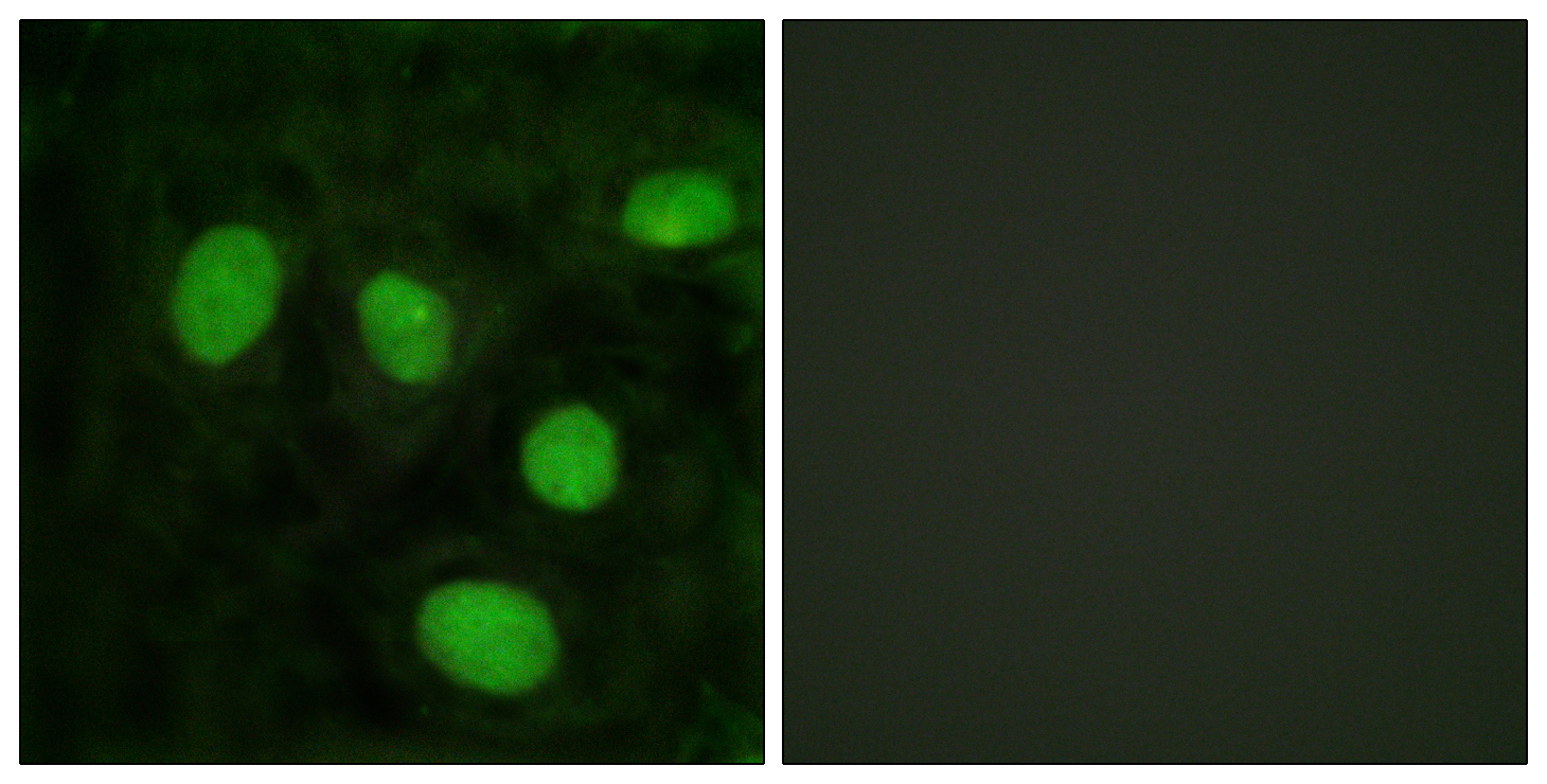 Histone H1.8