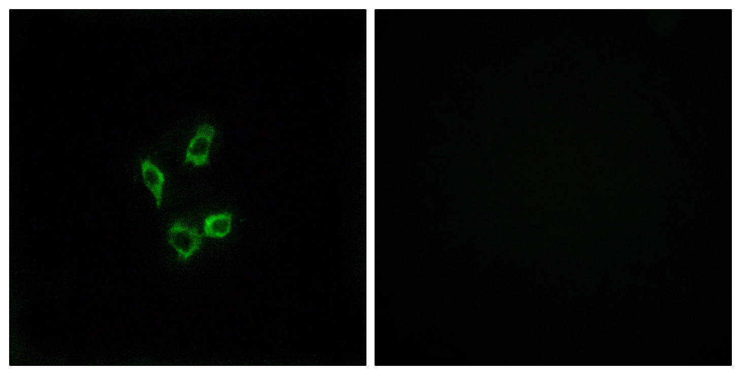 Cytochrome P450 4Z1
