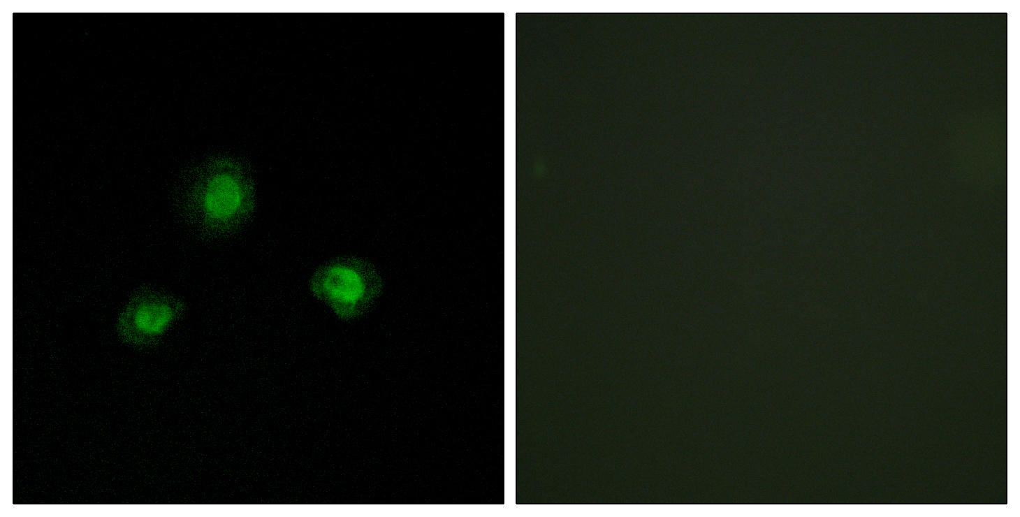 Ubinuclein 1