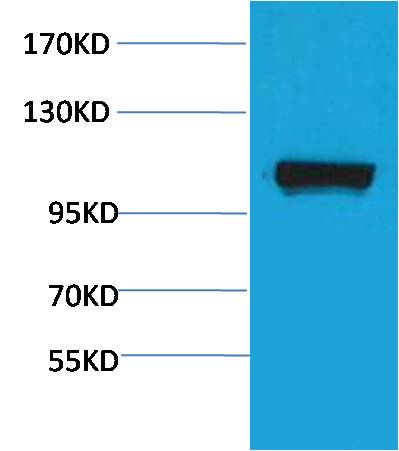 PEPC