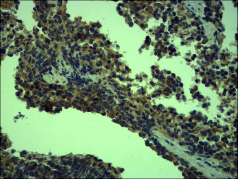 Toll-Like Receptor 4