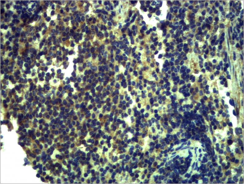 Toll-Like Receptor 13