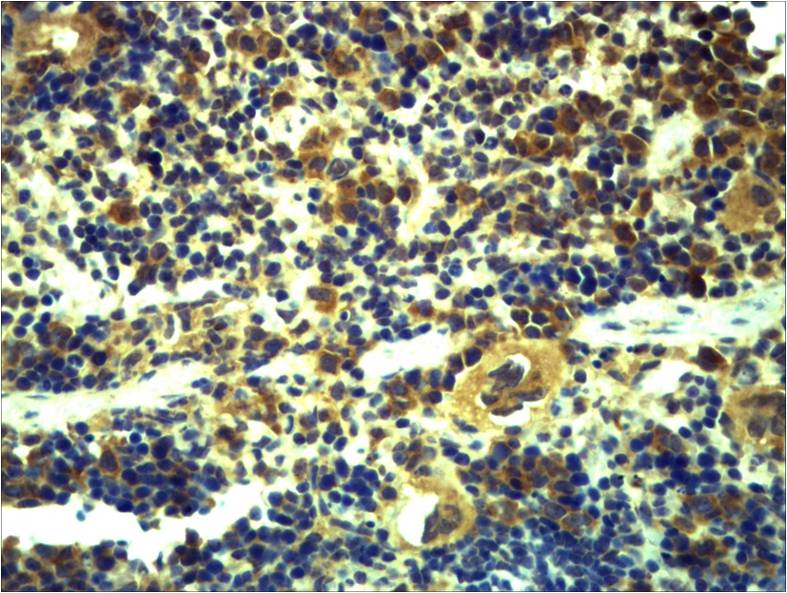 Toll-Like Receptor 6