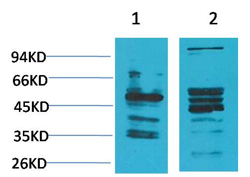 Neuromedin B Receptor