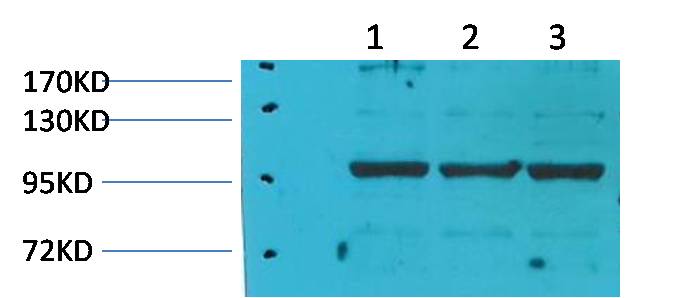Elongation Factor 1A2 Binding Protein