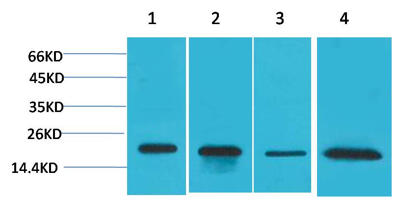 Superoxide Dismutase 1