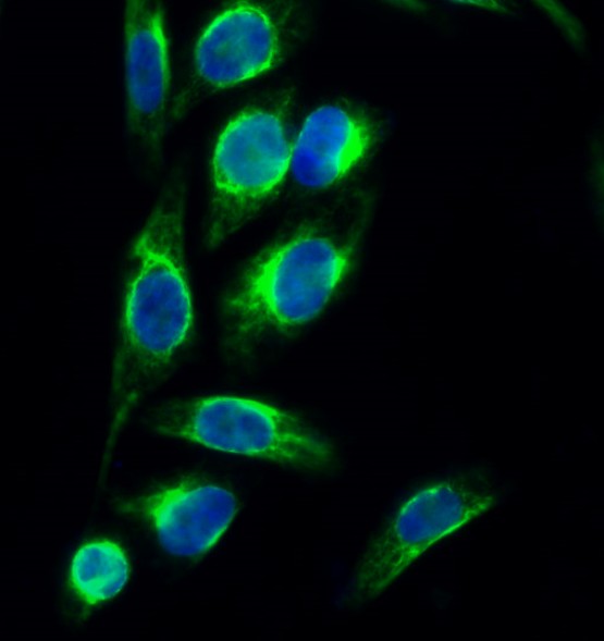 Rabbit Polyclonal Antibody to PERK