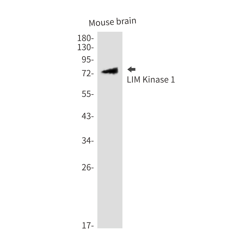 LIM Kinase 1
