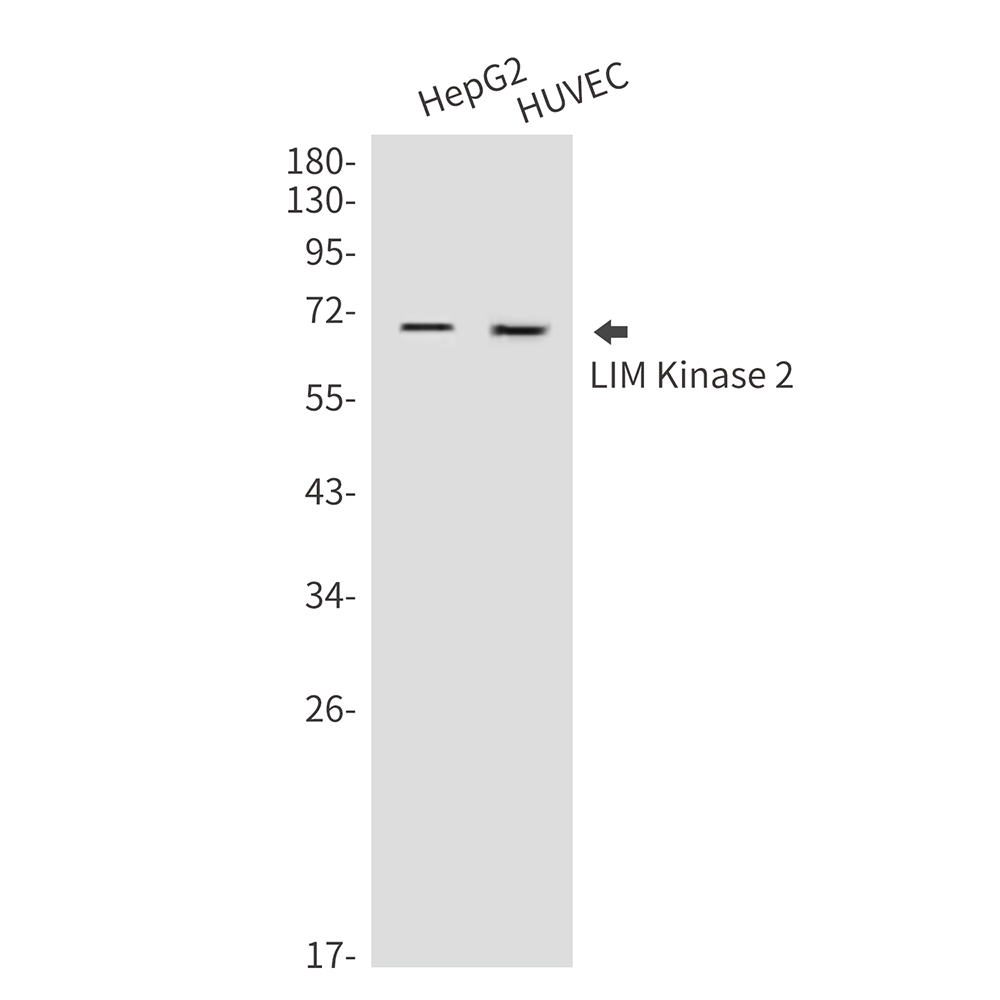 LIM Kinase 2