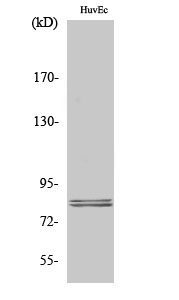 Hormone Sensitive Lipase