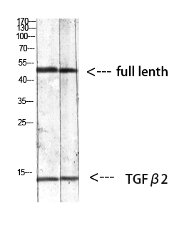 TGF beta 2