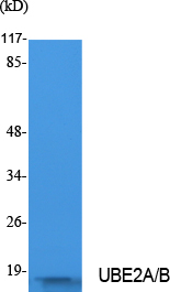 Ubiquitin Conjugating Enzyme E2 A/B