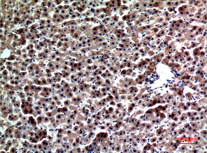 Rabbit Polyclonal Antibody to FGL1
