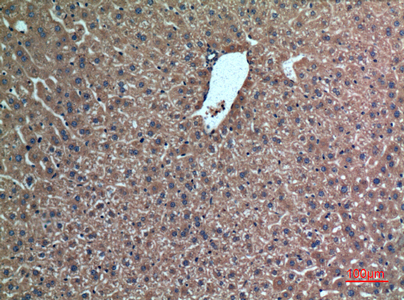Rabbit Polyclonal Antibody to FGL1