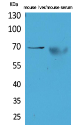 alpha 1 Fetoprotein