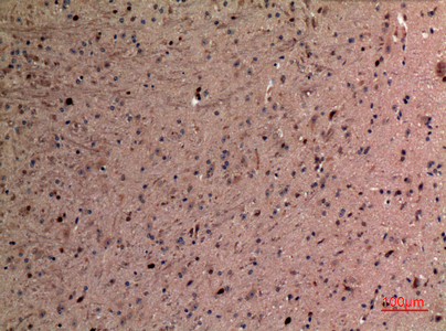 Rabbit Polyclonal Antibody to alpha 1 Fetoprotein