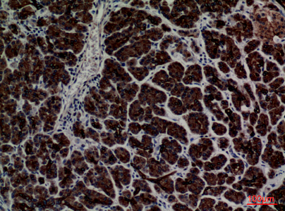 Rabbit Polyclonal Antibody to CD1E