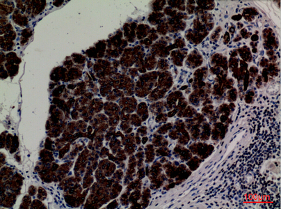 Rabbit Polyclonal Antibody to CD1E