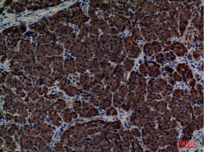 Rabbit Polyclonal Antibody to CD1E