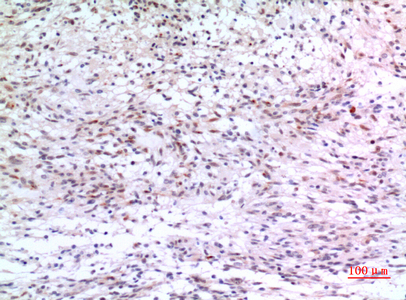 Rabbit Polyclonal Antibody to ZNF307