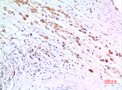 Rabbit Polyclonal Antibody to ZNF307