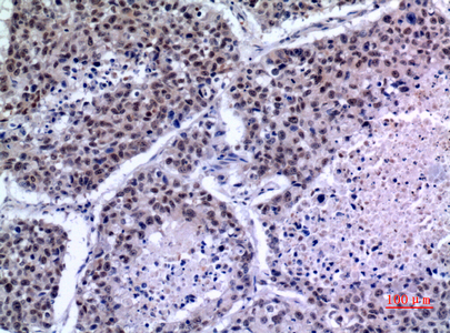 Rabbit Polyclonal Antibody to KLF13