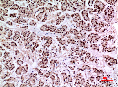 Rabbit Polyclonal Antibody to KLF13
