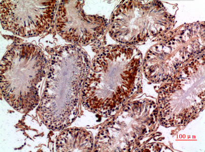 Rabbit Polyclonal Antibody to NTE