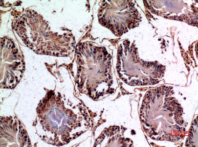 Rabbit Polyclonal Antibody to NTE