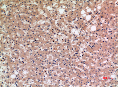 Rabbit Polyclonal Antibody to SLC10A1