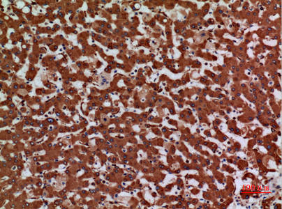 Rabbit Polyclonal Antibody to Laminin gamma 2