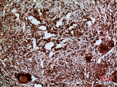 Rabbit Polyclonal Antibody to Laminin gamma 2