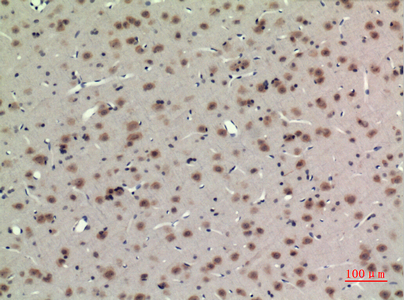 Rabbit Polyclonal Antibody to BMAL1