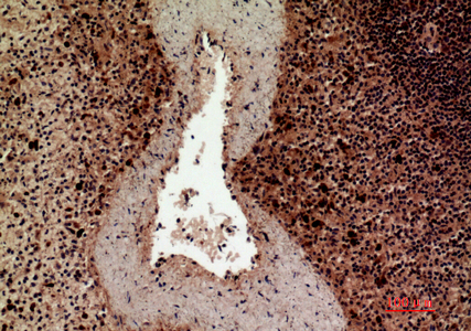 Rabbit Polyclonal Antibody to HLA DQB1/2