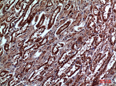 Rabbit Polyclonal Antibody to IGFBP3