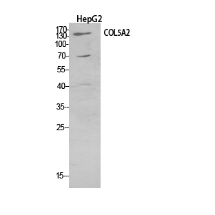 Collagen V alpha 2
