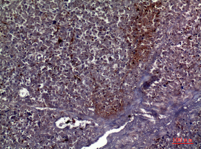 Rabbit Polyclonal Antibody to Collagen V alpha 2