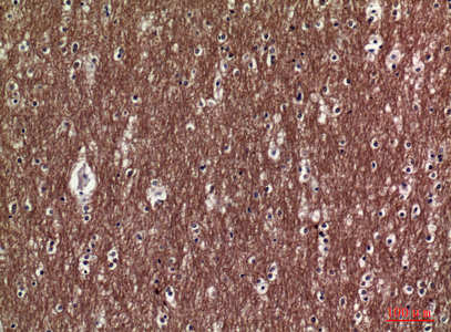 Rabbit Polyclonal Antibody to Collagen V alpha 2