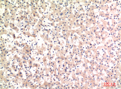 Rabbit Polyclonal Antibody to C4A/B