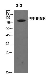 PPP1R15B