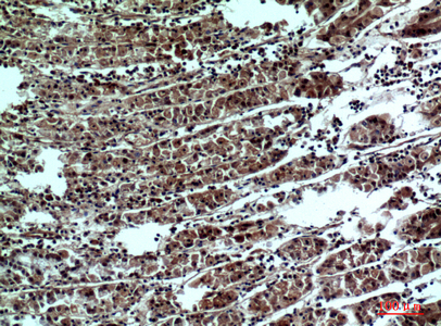 Rabbit Polyclonal Antibody to PPP1R15B