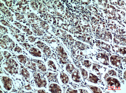 Rabbit Polyclonal Antibody to PPP1R15B