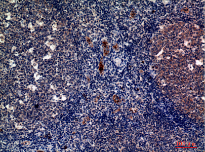 Rabbit Polyclonal Antibody to CD62P