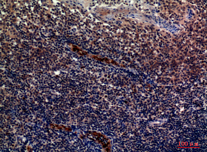 Rabbit Polyclonal Antibody to CD62P