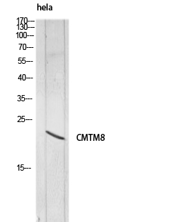 CMTM8
