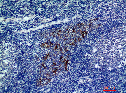 Rabbit Polyclonal Antibody to CMTM8