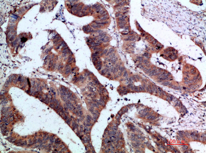 Rabbit Polyclonal Antibody to IL-37